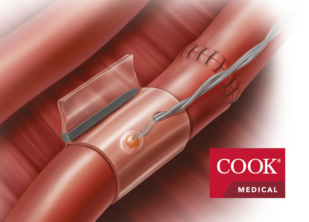 Doppler-Blutfluss-Monitor