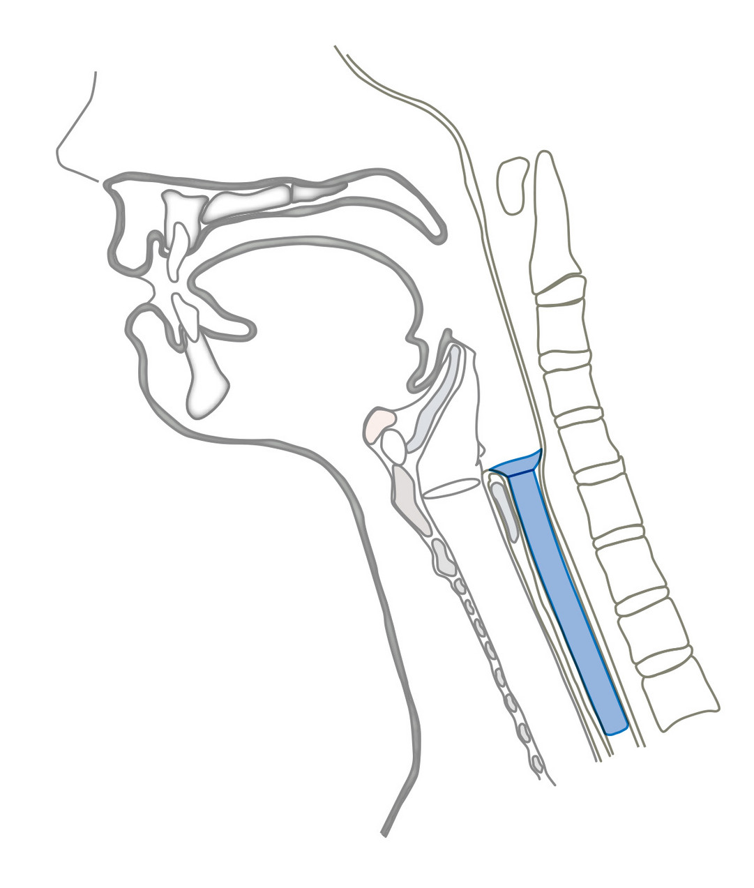 Montgomery® Speichel-Bypass-Tubus